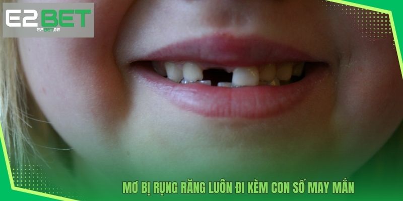 Mơ Bị Rụng Răng | Điềm Báo Những Con Số Tài Lộc Tại E2BET 3 Mơ bị rụng răng luôn đi kèm con số may mắn